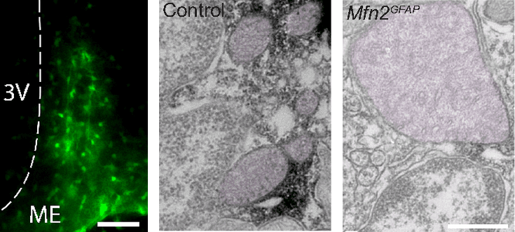 Panels e and f of Figure 6 from the astrocyte preprint: green fluorescent astrocytes in the arcuate nucleus of a mouse after virus-mediated removal of Mfn2, and electron micrographs of astrocyte mitochondria in a control and an Mfn2 knockout mouse.