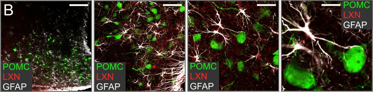 Four confocal images from Figure 20 of Jasna Jarc’s doctoral thesis, from overview to close-up, of astrocytes (white) carrying latexin (red) beside POMC neurons (green) in the arcuate nucleus of the mouse hypothalamus.